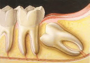 Oral-Surgery1