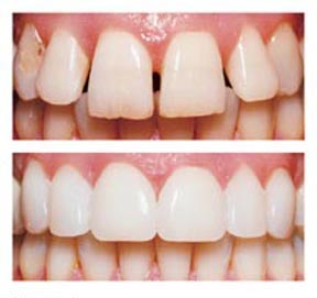 cosmetic-dentistry2
