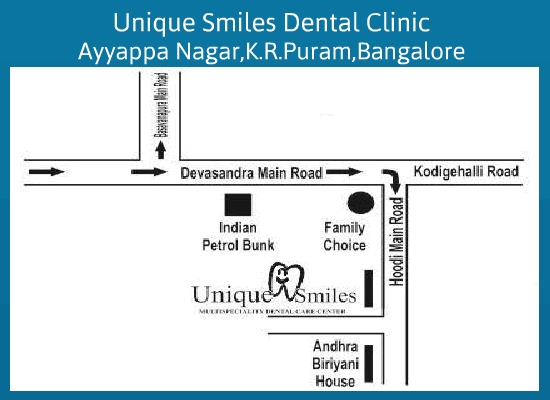 unique-smile_dental_clinic_bangalore
